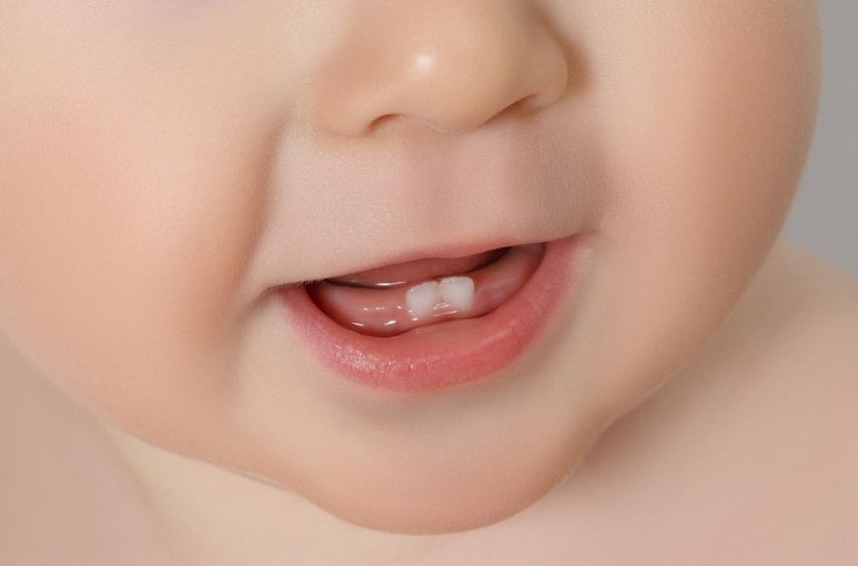 Dent d'enfant qui pousse. Sourire enfant
